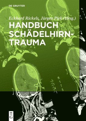 bokomslag Handbuch Schdelhirntrauma