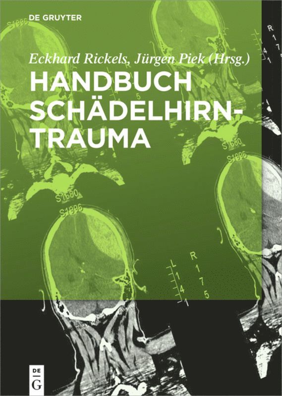 Eckhard Rickels, Jürgen Piek - Handbuch Schädelhirntrauma, Inbunden