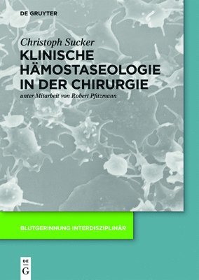 Klinische Hmostaseologie in der Chirurgie 1