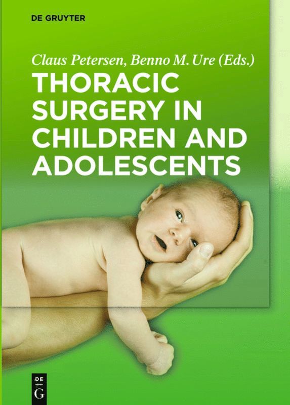 Claus Petersen, Benno M. Ure - Thoracic Surgery in Children and Adolescents, Inbunden