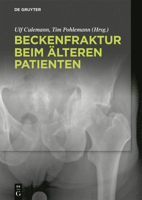 bokomslag Beckenfraktur beim älteren Patienten