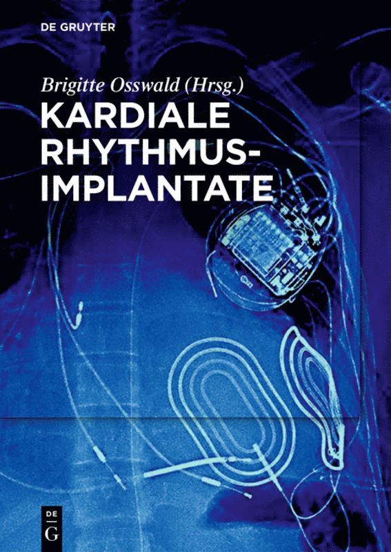 Brigitte Osswald - Kardiale Rhythmusimplantate, Häftad