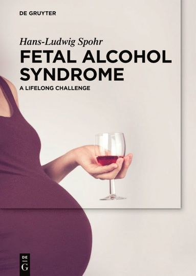 bokomslag Fetal Alcohol Syndrome