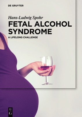 Fetal Alcohol Syndrome 1