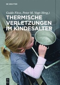 bokomslag Thermische Verletzungen im Kindesalter