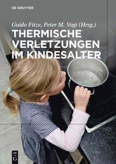 bokomslag Thermische Verletzungen im Kindesalter