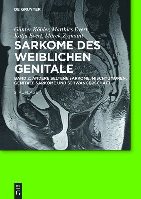 bokomslag Andere seltene Sarkome, Mischtumoren, genitale Sarkome und Schwangerschaft