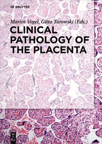 bokomslag Clinical Pathology of the Placenta