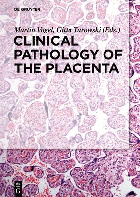 Clinical Pathology of the Placenta 1