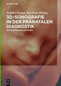bokomslag 3D-Sonografie in der prnatalen Diagnostik