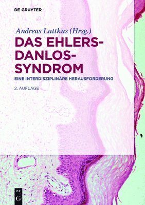 bokomslag Das Ehlers-Danlos-Syndrom