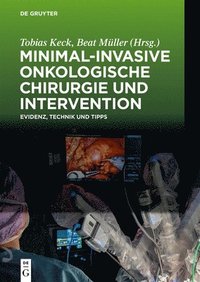 bokomslag Minimal-Invasive Onkologische Chirurgie Und Intervention: Evidenz, Technik Und Tipps