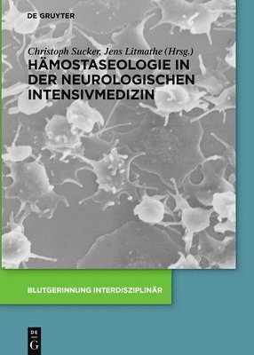 Christoph Sucker, Jens Litmathe - Hämostaseologie in der neurologischen Intensivmedizin, Inbunden