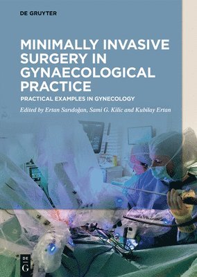 Ertan Saridoğan, Gokhan Sami Kilic, Kubilay Ertan, Ertan Saridoğan, Ertan Saridogan, Ertan Sarido¿an - Minimally Invasive Surgery in Gynecological Practice, Inbunden