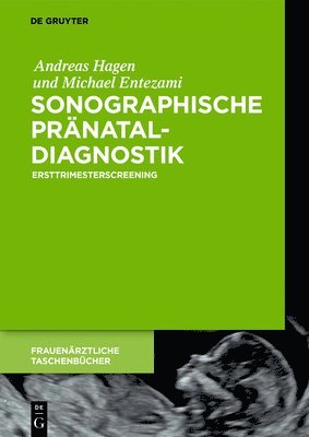 Andreas Hagen, Michael Entezami - Sonographische Pränataldiagnostik, Inbunden