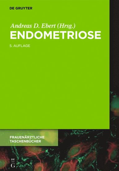 bokomslag Endometriose