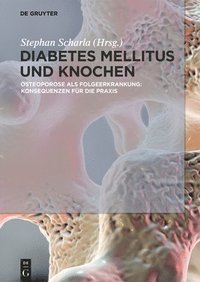 bokomslag Diabetes Mellitus und Knochen