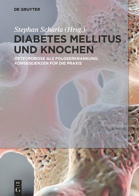 Diabetes Mellitus und Knochen 1