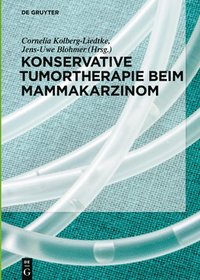 bokomslag Konservative Tumortherapie beim Mammakarzinom