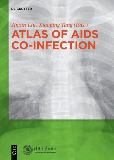 bokomslag Atlas of AIDS Co-infection