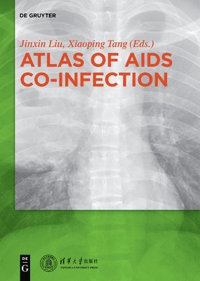 Atlas of AIDS Co-infection 1