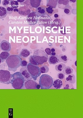 Myeloische Neoplasien 1