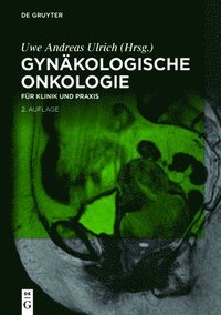 bokomslag Gynkologische Onkologie