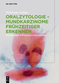 bokomslag Oralzytologie - Mundkarzinome frhzeitiger erkennen