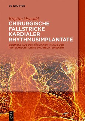 Chirurgische Fallstricke kardialer Rhythmusimplantate 1