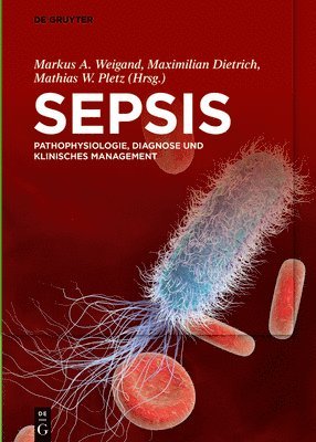 Sepsis 1