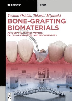 Bone-Grafting Biomaterials 1