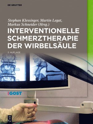 Stephan Klessinger, Martin Legat, Markus Schneider - Interventionelle Schmerztherapie Der Wirbelsäule, Inbunden