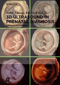 bokomslag 3D Ultrasound in Prenatal Diagnosis