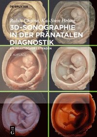 bokomslag 3D-Sonographie in der pränatalen Diagnostik