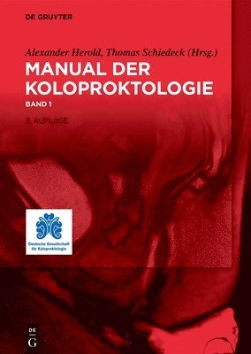 Alexander Herold, Thomas Schiedeck - Manual Der Koloproktologie, Inbunden