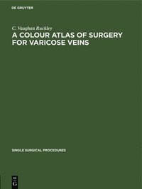 bokomslag A Colour Atlas of Surgery for Varicose Veins