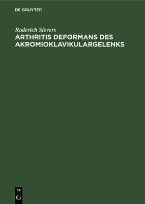 Roderich Sievers - Arthritis Deformans Des Akromioklavikulargelenks, Inbunden