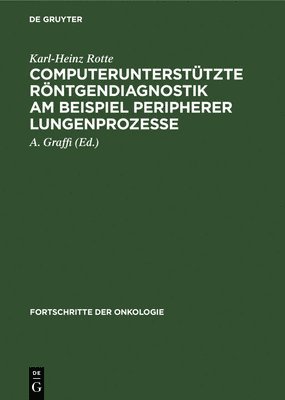 Computeruntersttzte Rntgendiagnostik Am Beispiel Peripherer Lungenprozesse 1