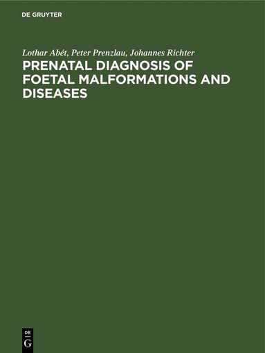 Lothar Abét, Peter Prenzlau, Johannes Richter - Prenatal Diagnosis of Foetal Malformations and Diseases, Inbunden