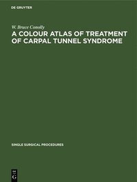 bokomslag Colour Atlas of Treatment of Carpal Tunnel Syndrome