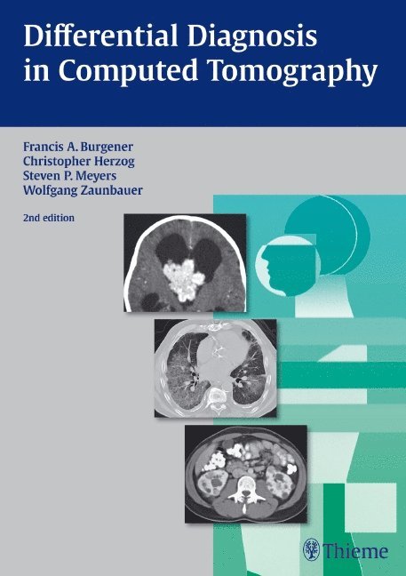 Francis A. Burgener, Christopher Herzog, Steven Meyers, Wolfgang Zaunbauer - Differential Diagnosis in Computed Tomography, Inbunden