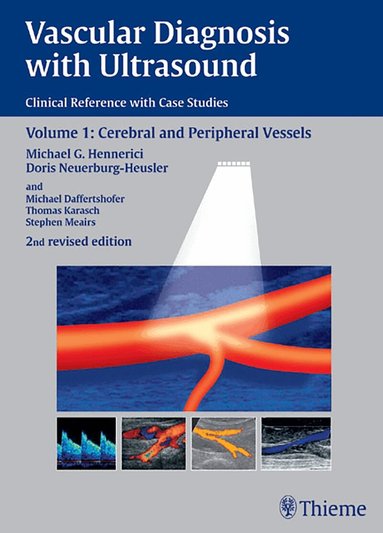 Michael G. Hennerici, Doris Neuerburg-Heusler - Vascular Diagnosis with Ultrasound, Inbunden