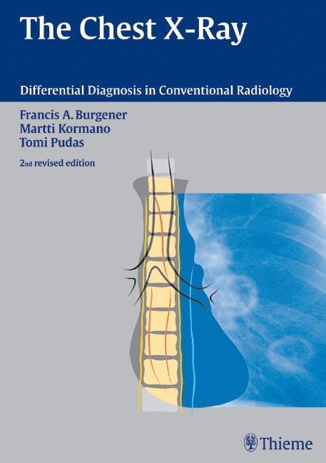 Francis A. Burgener, Martti Kormano, Tomi Pudas - Chest X-Ray, Inbunden
