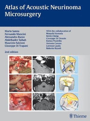 bokomslag Atlas of Acoustic Neurinoma Microsurgery