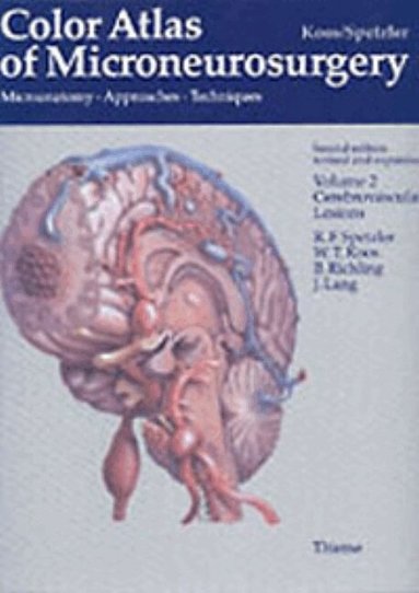 Wolfgang T. Koos, Robert F. Spetzler, Bernd Richling, Johannes Lang - Color Atlas of Microneurosurgery: Volume 2 - Cerebrovascular Lesions, Inbunden