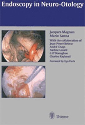 bokomslag Endoscopy in Neuro-Otology and Skull Base Surgery (AT)