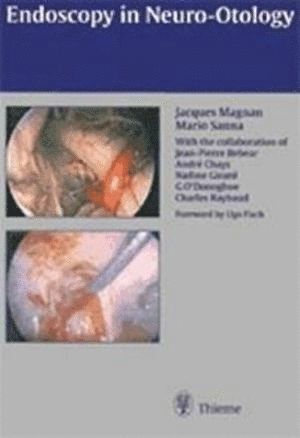 Jacques Magnan, Jacques Magnan, MD, Mario Sanna - Endoscopy in Neuro-Otology and Skull Base Surgery (at), Inbunden