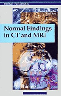 bokomslag Normal Findings in CT and MRI