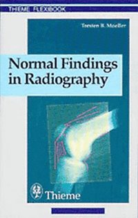 bokomslag Normal Findings in Radiography