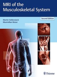 bokomslag MRI of the Musculoskeletal System